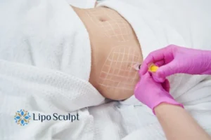 Are The Results From Aqualyx Permanent? 1 Do you want to know how long Aqualyx Leigh-on-Sea results last?